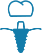 Implants-in-titanium